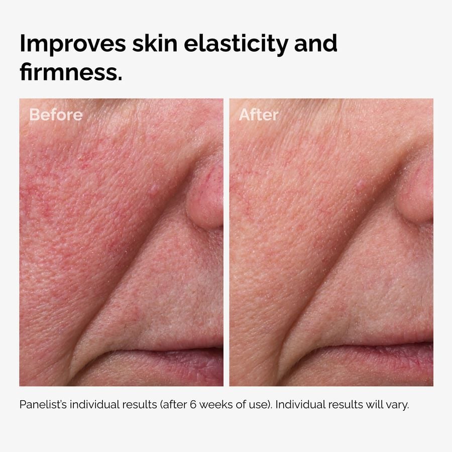 The Ordinary Face Oil - 100% Fermented Rose Hip Seed | Product Guide　XX LX