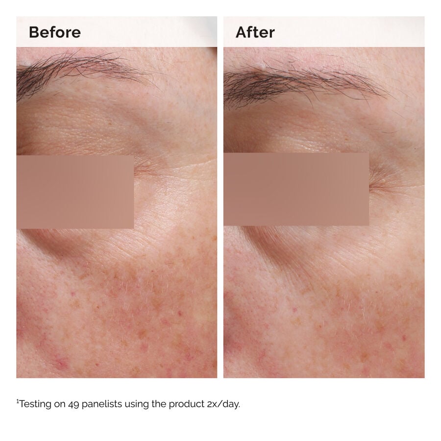 The Ordinary Face and Body Emulsion with Niacinamide 5% — Product Information　nP pn