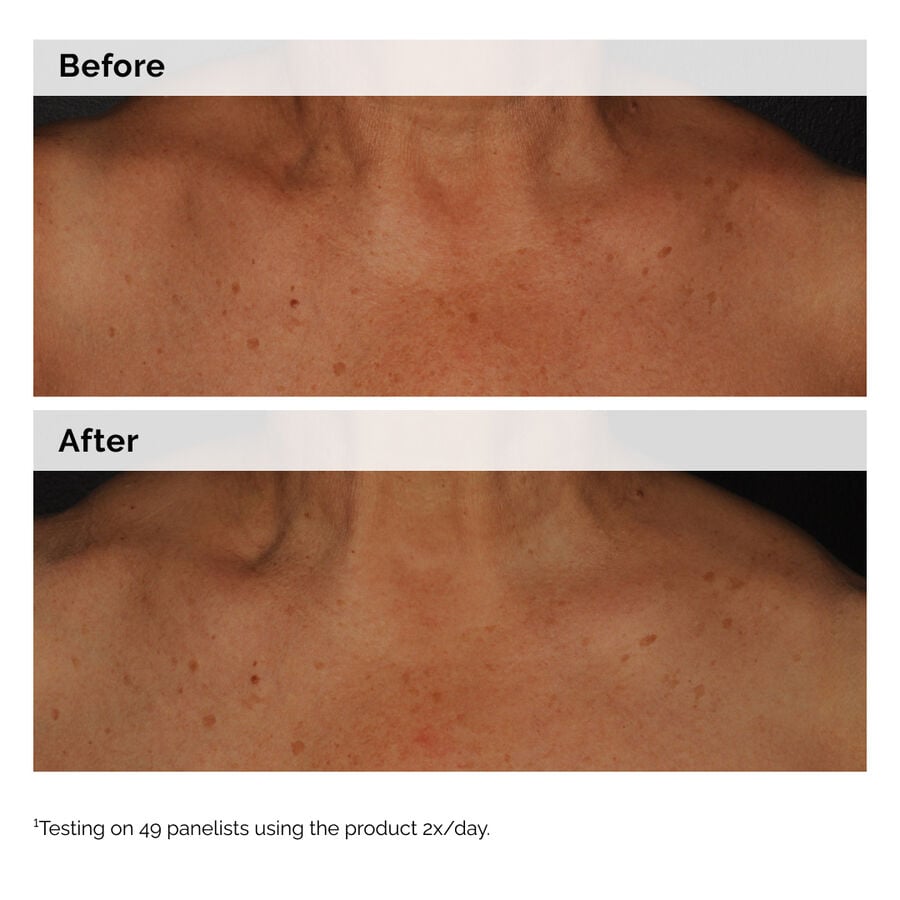 The Ordinary Face and Body Emulsion with Niacinamide 5% — Product Information　nP pn