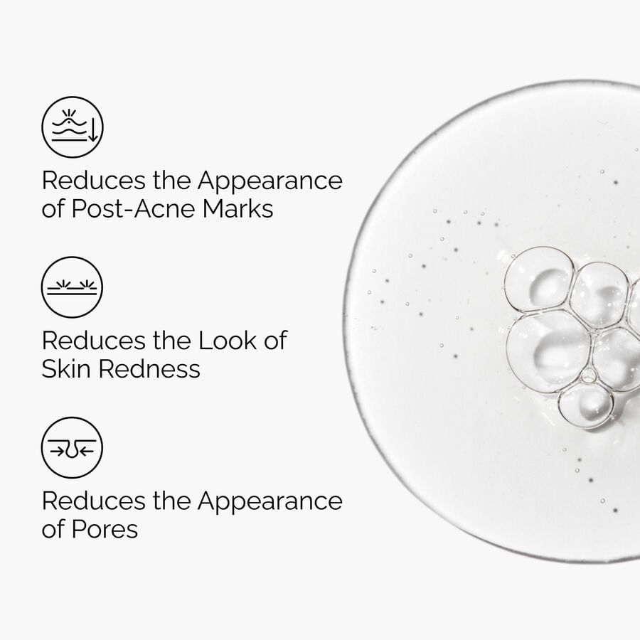 The Ordinary Blemish Solution with Aloe 2% and NAG 2% | Item Overview　Me 3v