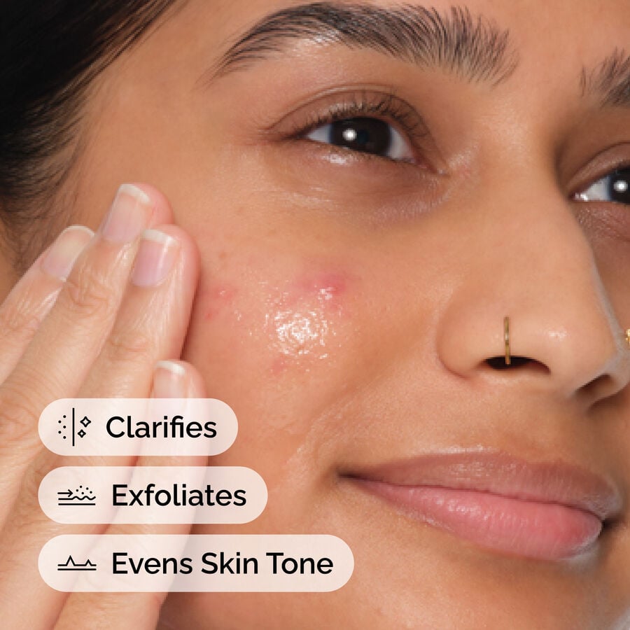 The Ordinary Exfoliating Treatment - Salicylic Acid 2% Anhydrous Solution — Item Information　VJ sd