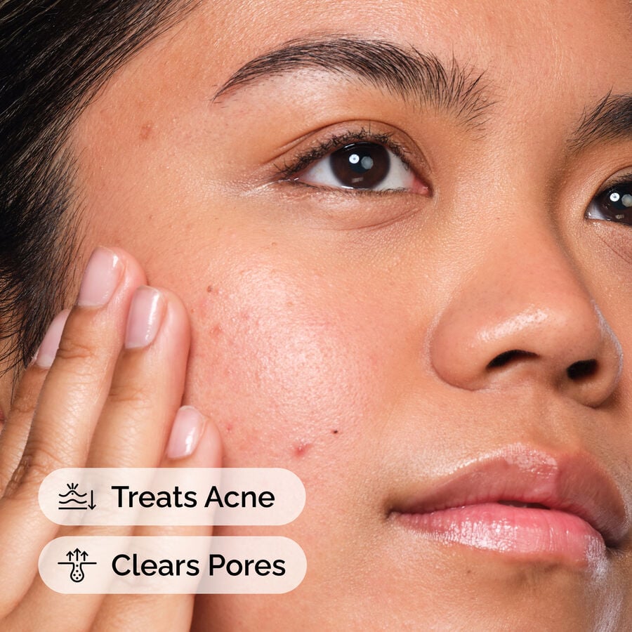 The Ordinary Exfoliating Treatment - Salicylic Acid 2% Solution — Product Facts　ip i8