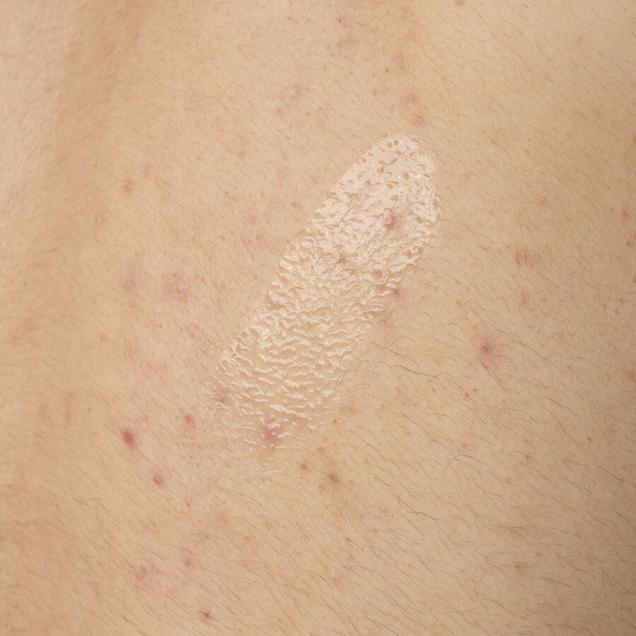The Ordinary Body Care Treatment - Salicylic Acid 0.5% Body Serum | Product Features　3h 5g