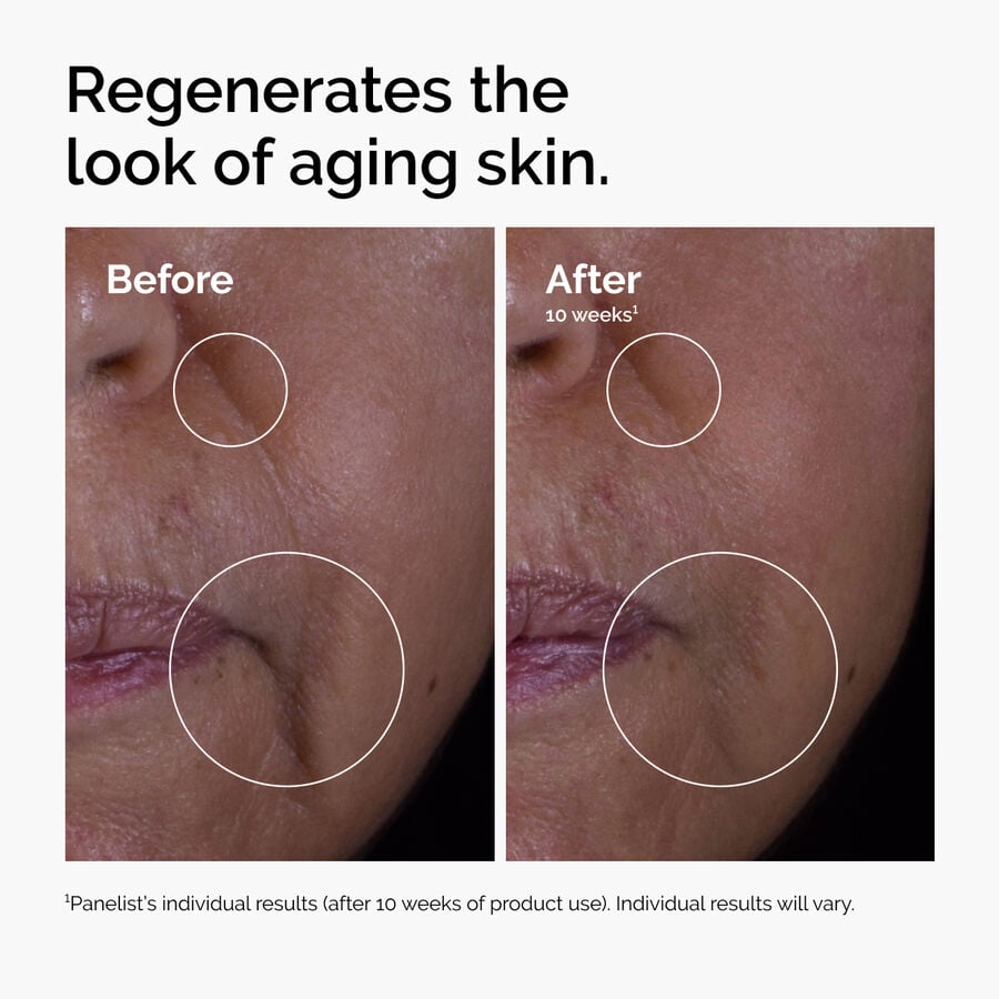 The Ordinary Treatment - GF 15% Solution | Product Features　bJ iu