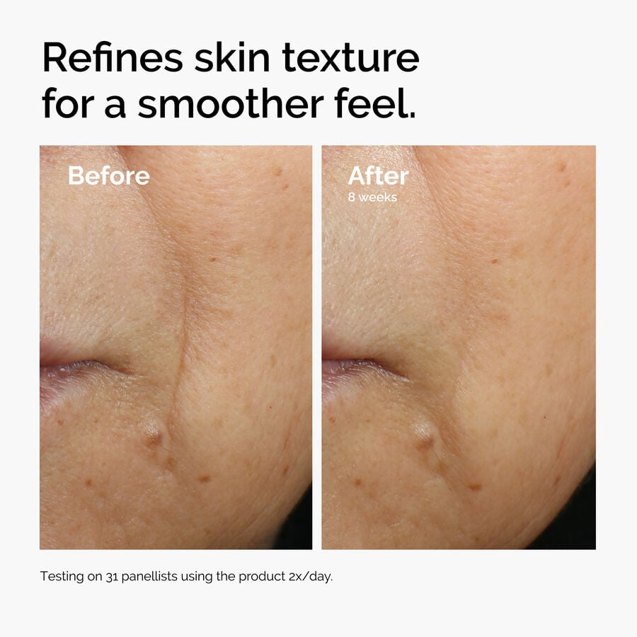 The Ordinary Energizing Face Serum with Caffeine 3% and Escin 1% | Detailed Overview　xo i7