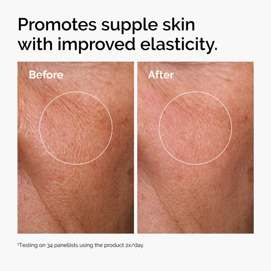 The Ordinary Treatment - Hyaluronic Acid 2% + B5 (with Ceramides) — Full Product Details　Z3 jx
