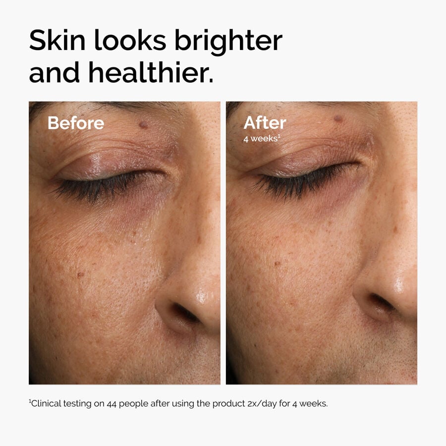 The Ordinary Treatment - Multi-Antioxidant Radiance Serum — Product Information　Bc e7