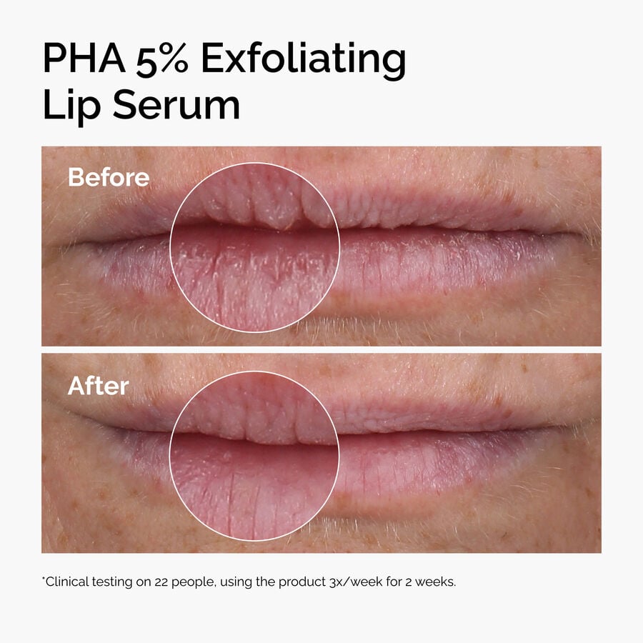 The Ordinary Lip Exfoliating Serum with PHA 5% — Item Information　7R 32