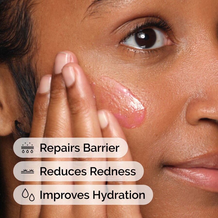 The Ordinary Treatment - Soothing & Barrier Support Serum | Product Features　IA R4
