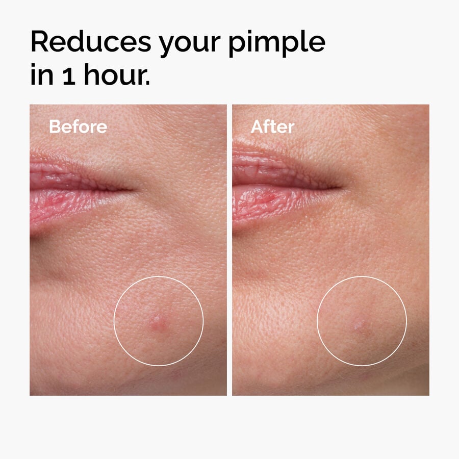 The Ordinary Sulfur 10% Powder-to-Cream Treatment — Full Product Details　9W N2